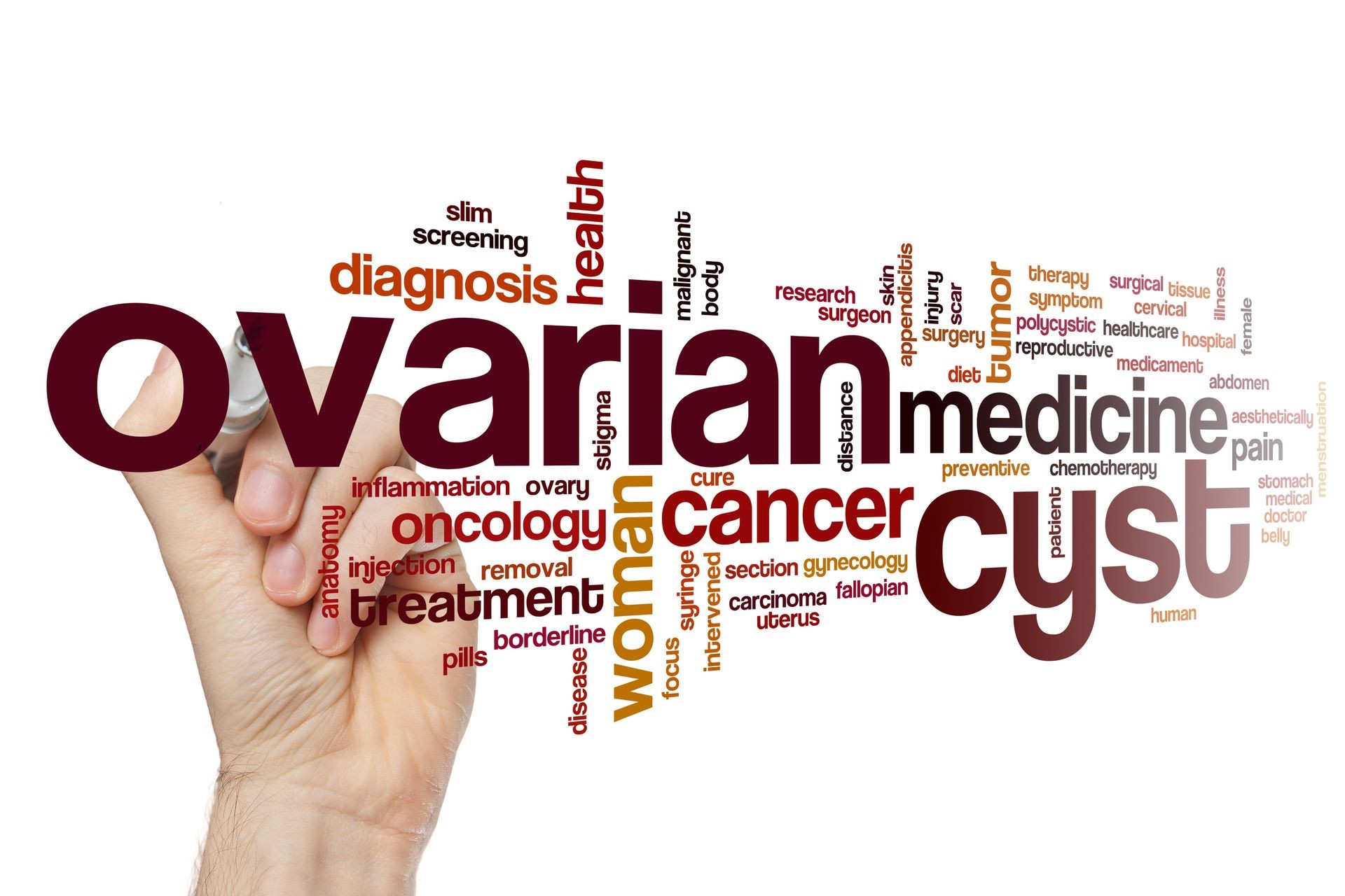 Ovarian cyst word cloud concept